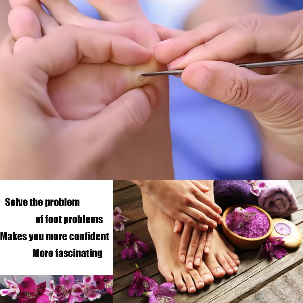 Exfoliating Ingrown Toenail Removal Pedicure Knife,Decorative Foot Knives for Ingrown Callus Shaver Feet Nail Correction Pliers Scissors Corn Remover With Storage Bag (1)